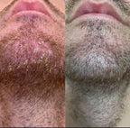 Thatched™ Beard Treatment Cream