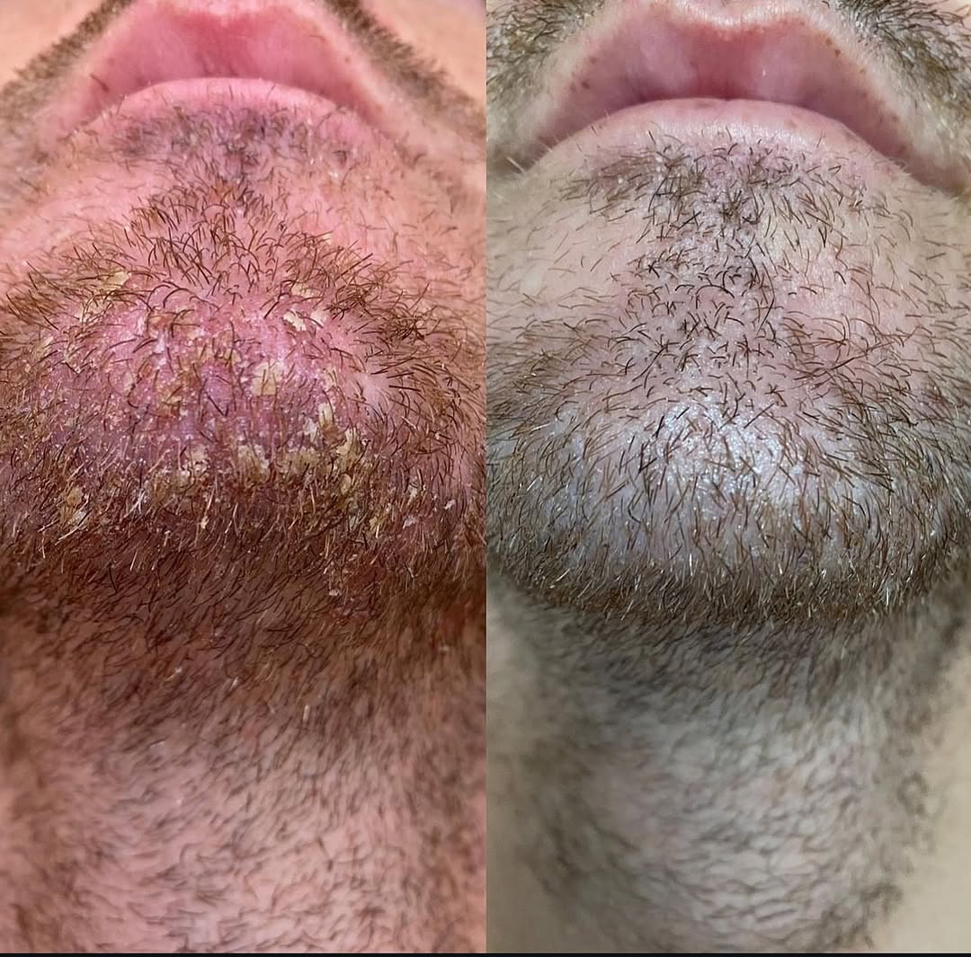 Thatched™ Beard Treatment Cream