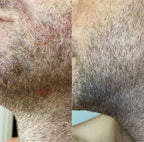 Thatched™ Beard Treatment Cream