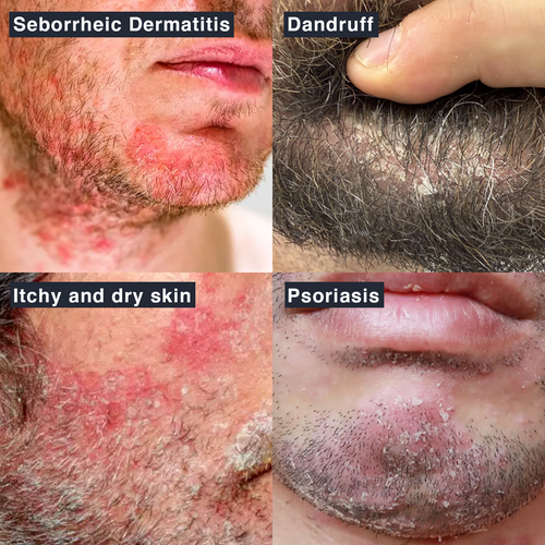 Thatched™ Beard Treatment Cream