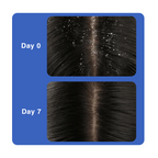 Thatched™ Scalp Treatment Cream
