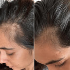 Red Light Scalp Massager